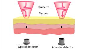Optical vs. acoustic detector