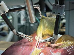 SRT-H performs surgery,