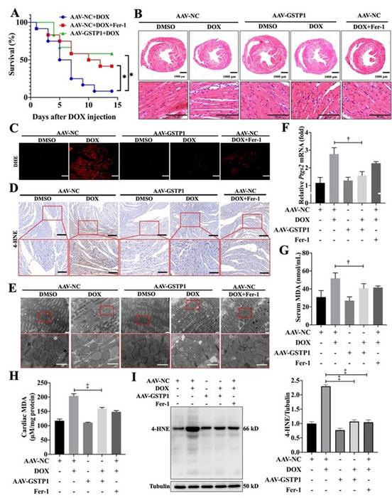 GSTP1 overexpression alleviates DOX-induced cardiomyopathy by reducing oxidative stress and preventing cardiac injury.