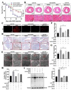 GSTP1 overexpression alleviates DOX-induced cardiomyopathy by reducing oxidative stress and preventing cardiac injury.