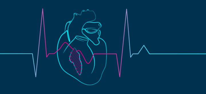 Heart Beating
