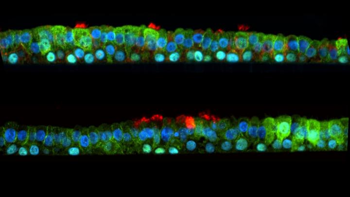 Human airway epithelium used to test nasal spray