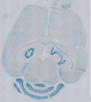 Del-1 in the Brain