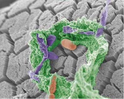 Altered Gut Microbiota