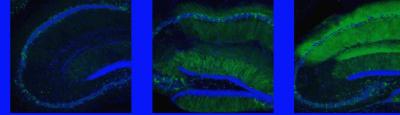 AMPA receptors