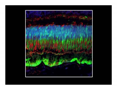 Next Generation Gene Therapy