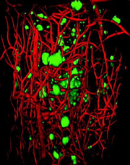 3-D Visualization of A&beta; Plaques (2 of 2)