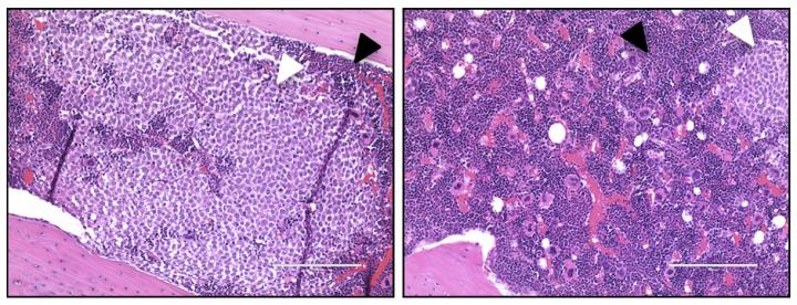 IL1RAP Antibodies Suppress AML Pathogenesis in Mice