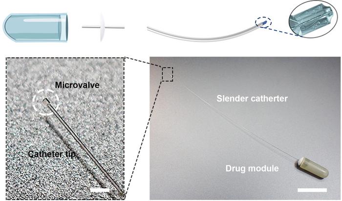 A laser-carved “liquid diode” at the tip of a drug-delivery catheter