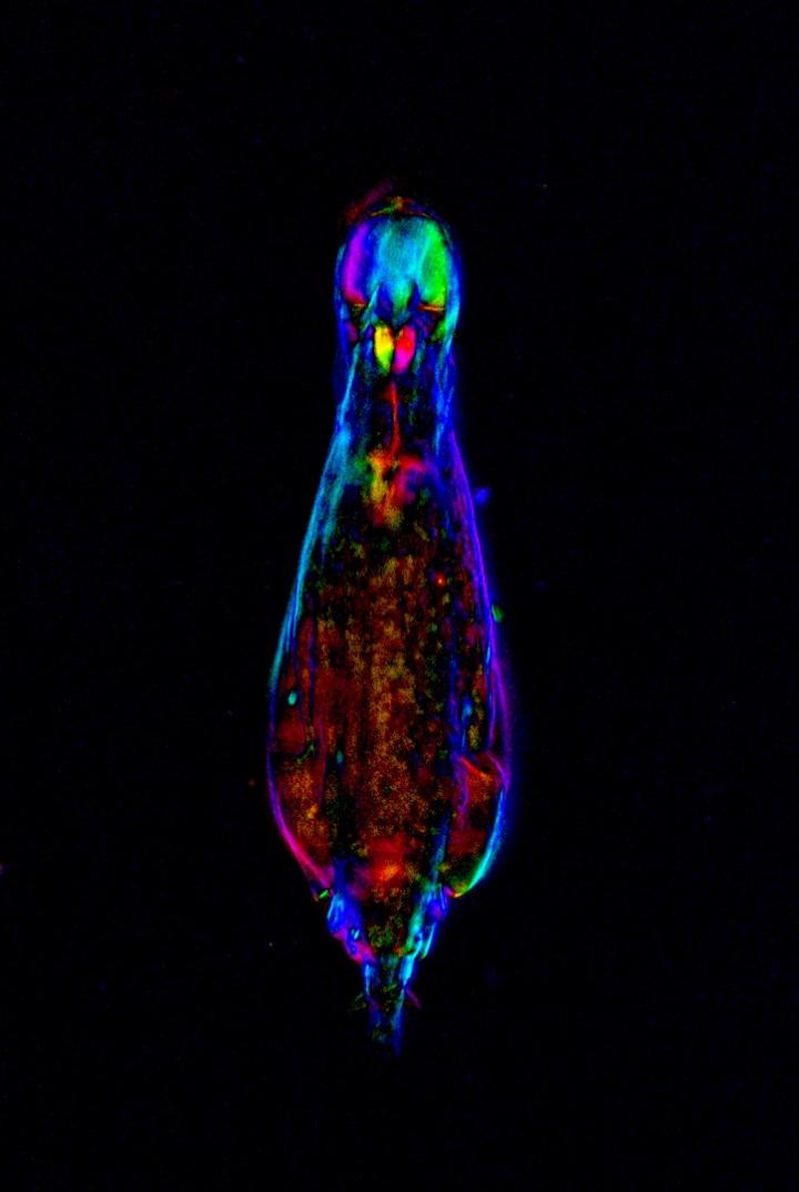 Bdelloid Rotifer <em>Adineta vaga </em>in Motion