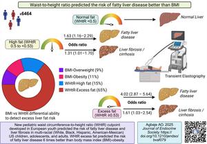 Waist-to-height ratio estimated fat mass detected the risk of fatty liver disease and liver cirrhosis better than BMI-obesity.