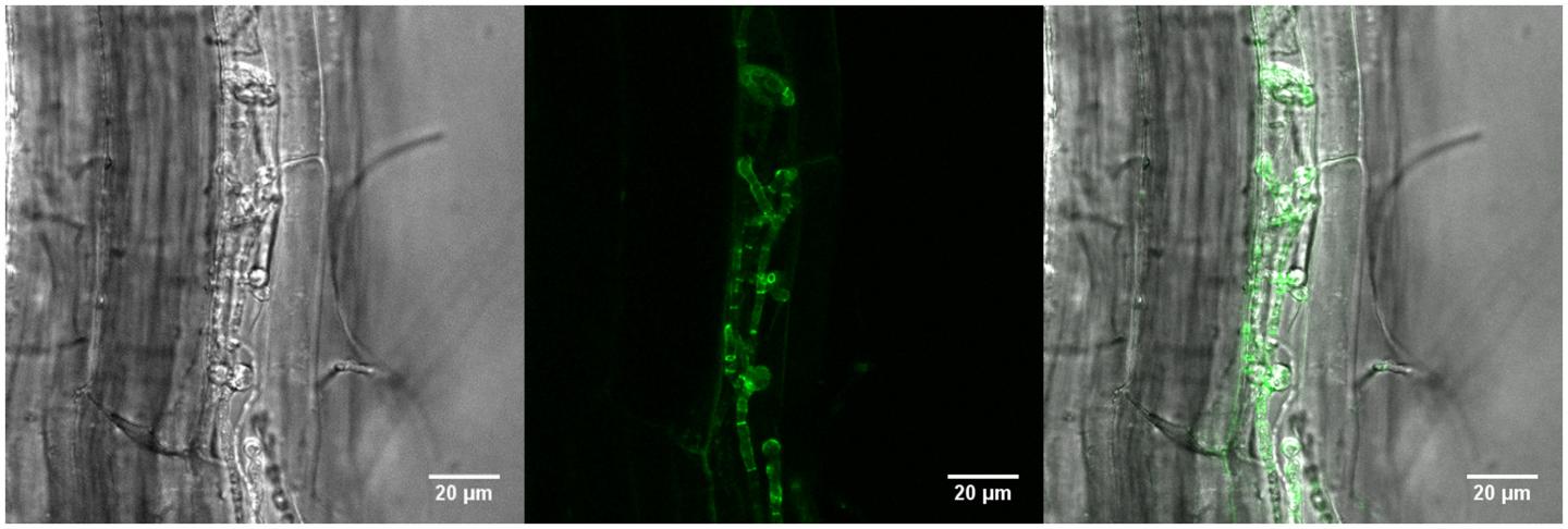 Fungus Populates a Plant Root