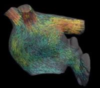 Heart Image