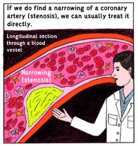 Comic: Stenosis