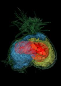 3D model of Squamellaria tenuiflora