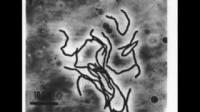 Making Clean Methane from Microbes (2 of 2)