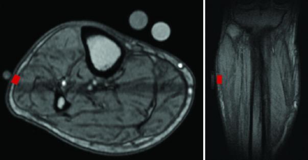 Box-Sized Sensor Brings Portable, Noninvasive Fluid Monitoring to the Bedside (2 of 11)