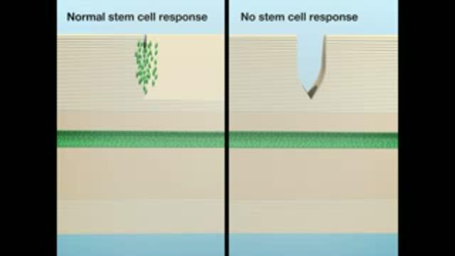 Animation of Stem Cell Scarring and Spinal Cord Injury