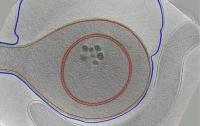 <i>A. Longum</i> Undergoing Sporulation