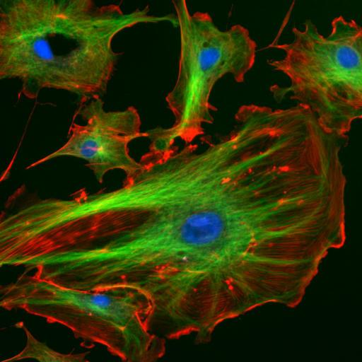 A Cellular Cytoskeleton (2 of 2)