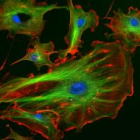 A Cellular Cytoskeleton (2 of 2)