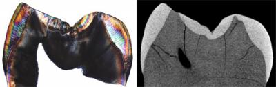 Fig. 2: Physical Section of the Neanderthal's First Molar Tooth Crown