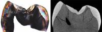 Fig. 2: Physical Section of the Neanderthal's First Molar Tooth Crown