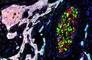 Human oral cancer cells express abundant EGFR