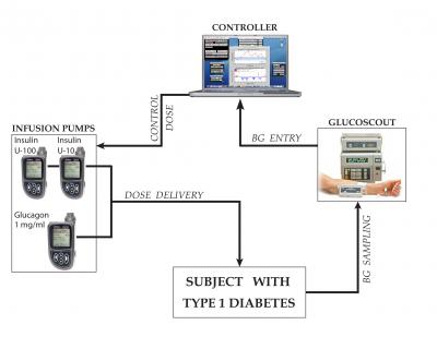 Controlling Diabetes: Meet Your Artificial Pancreas