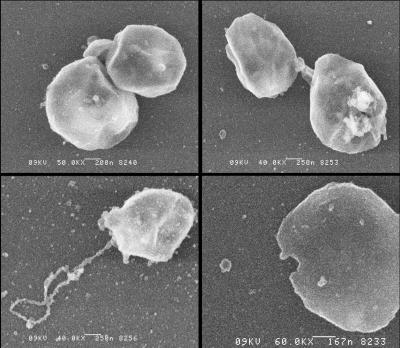 Dehalococcoides