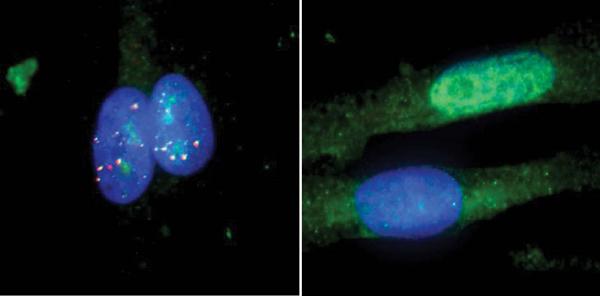 Muscle Cells, UC San Diego School of Medicine, Yeo Lab