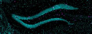 The dense bands of neurons pictured are the two blades of the dentate gyrus of the hippocampus in the brain.