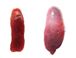 In situ liver regeneration