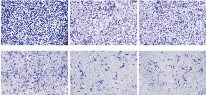 Invasive glioma cells transfected with lentivirus in SNB19 and U251 cells.