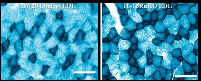 IL‑15R‑alpha Deficiency Increases Mitochondrial Content