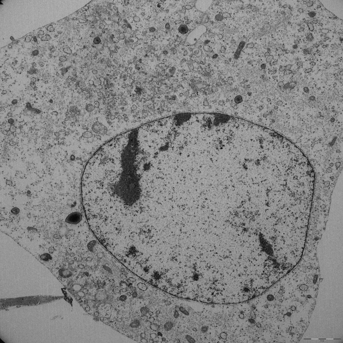 Ferroptosis