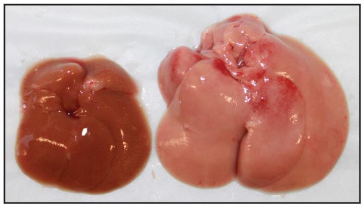 The Consequences of a High Fat Diet on a Compromised Liver