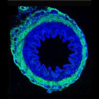 Villi, Structures within the Gut