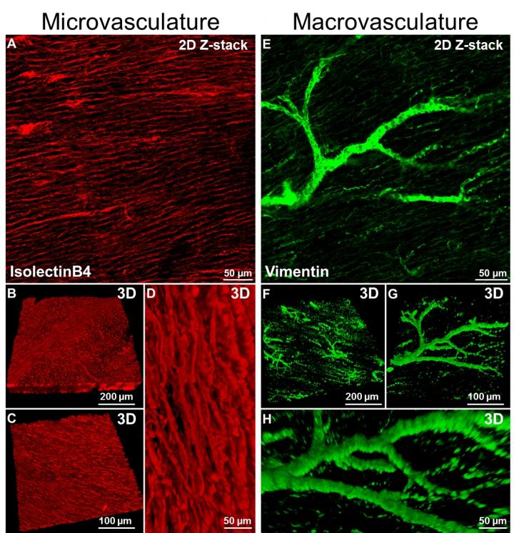 Transparent Heart Tissue Reveal Complex Vasculature