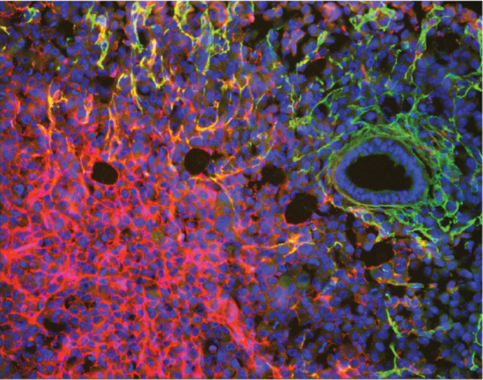 Triple negative breast cancer cell line
