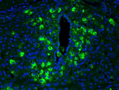 Fetuses Emit Hormone Crucial to Preventing Preeclampsia