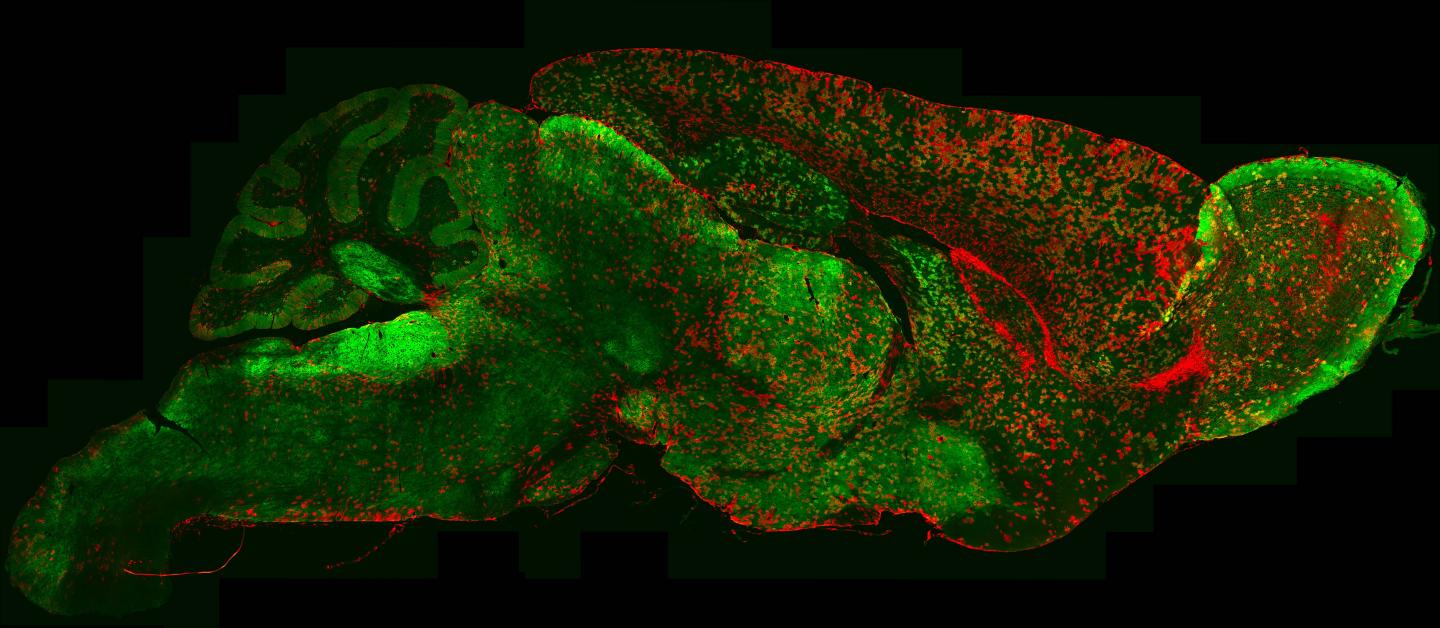 Microscope Image Showing Astrocyte Diversity across the Mouse Brain