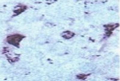 Golgi Apparatus