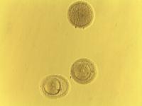 Preserving Human Eggs