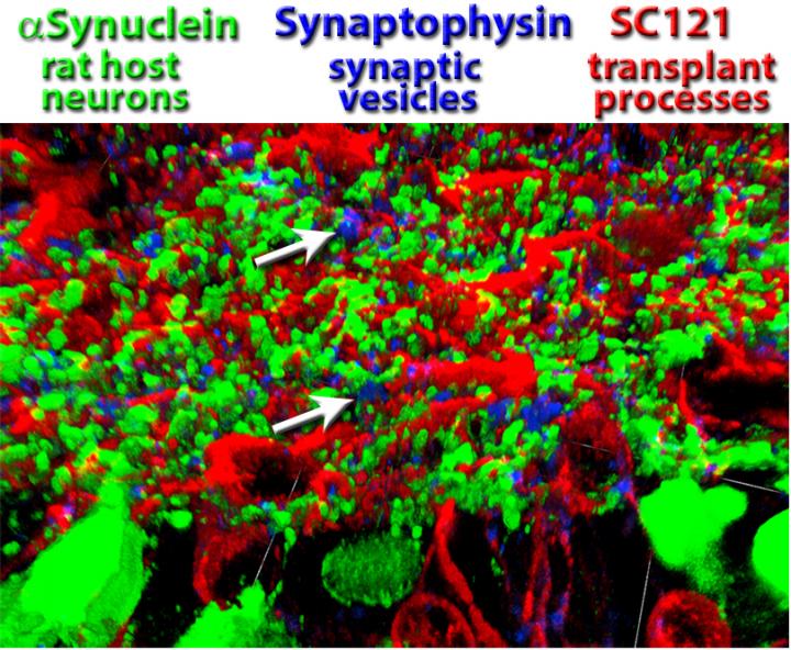 Retina Transplant Connectivity