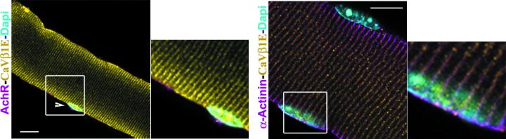 CaVbeta1E Protein