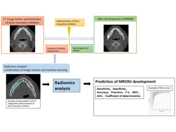 Predicting risk of developing medication-related osteonecrosis of the jaw_MRONJ