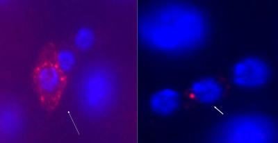 Delta Protein Signals Cell Fate in Fruit Fly Intestinal Stem Cells