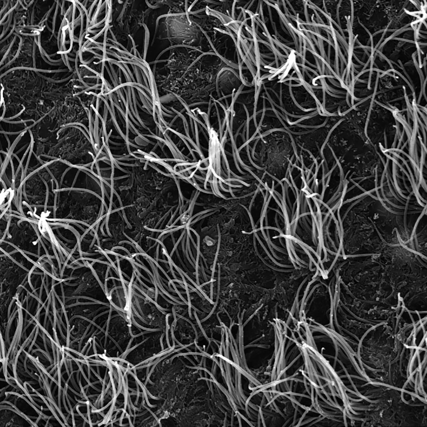Ependymal Cells
