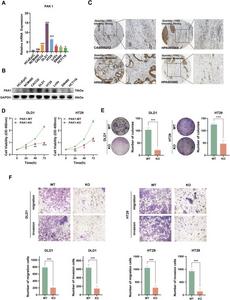 PAK1 deficiency inhibits CRC progression